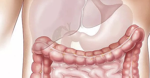 网络配图 网络配图